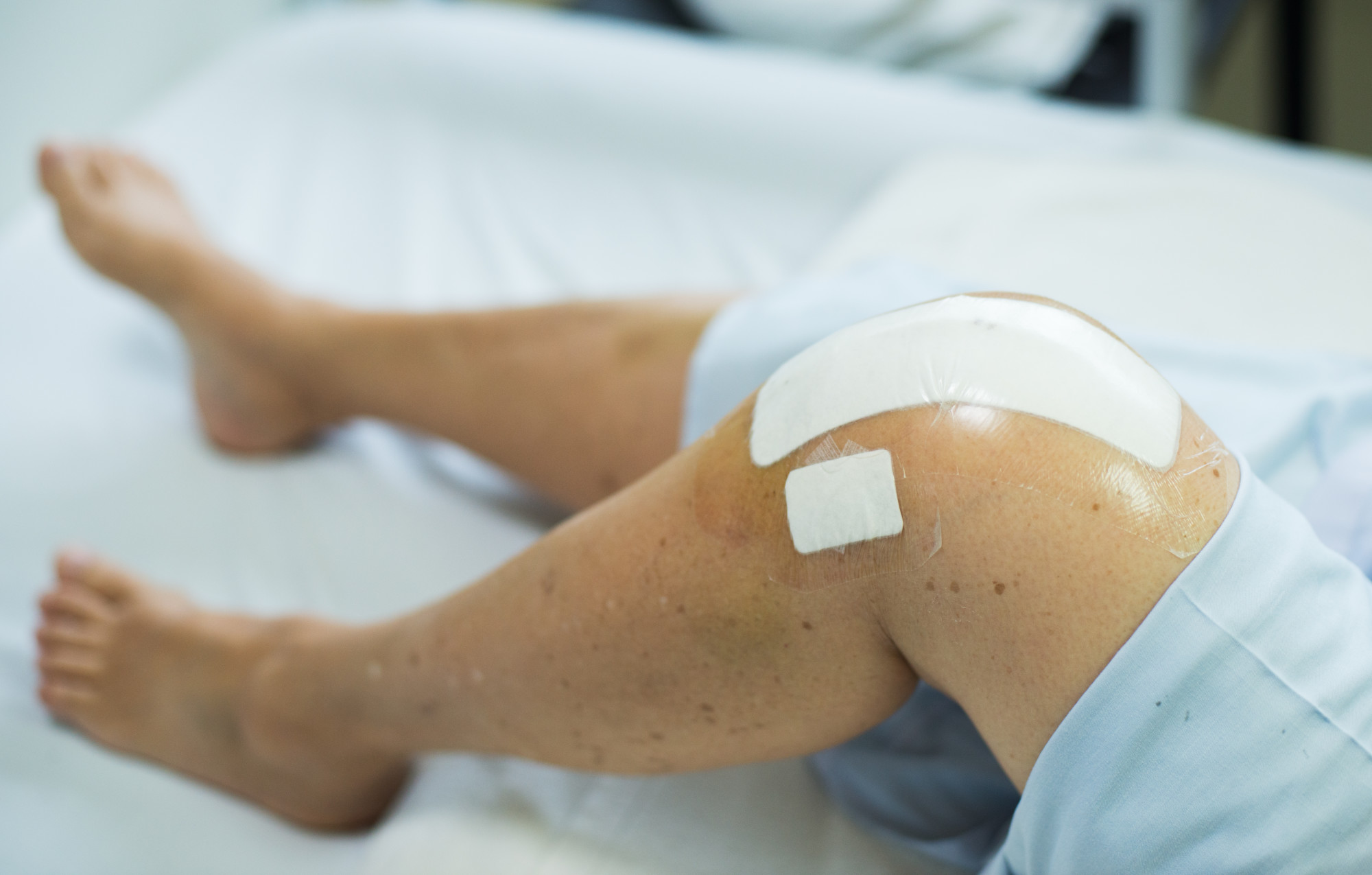 How Does a Knee Surgeon Help With a Personal Injury Case?