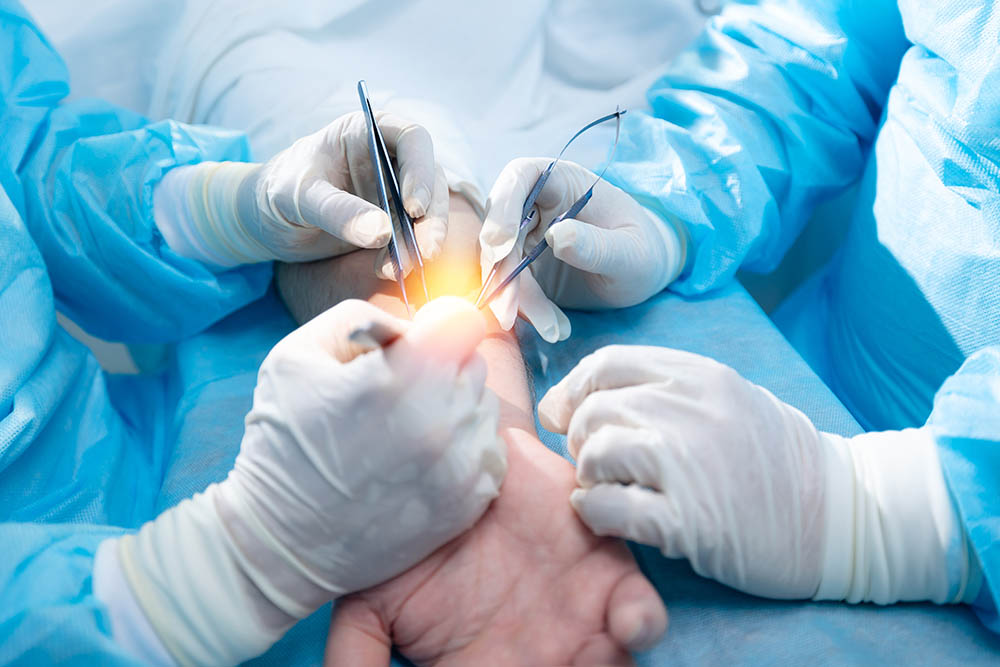Hand and Wrist Injuries in “Rear-End” Collisions: The Role of an Upper Extremity Specialist